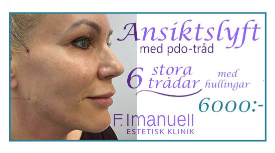 trådar insta 13